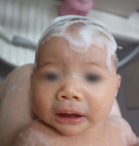 生後1か月の赤ちゃん向け ニキビ 湿疹はローションによる十分な保湿が重要 Tamao S Blog タマブロ